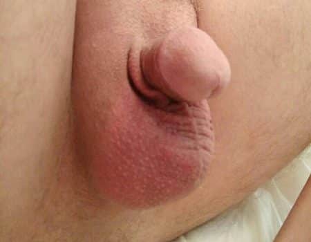 Tiny Dick Fetish