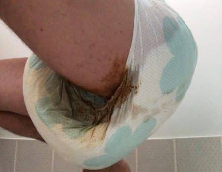 A boy Wearing The Very Dirty leaky diaper