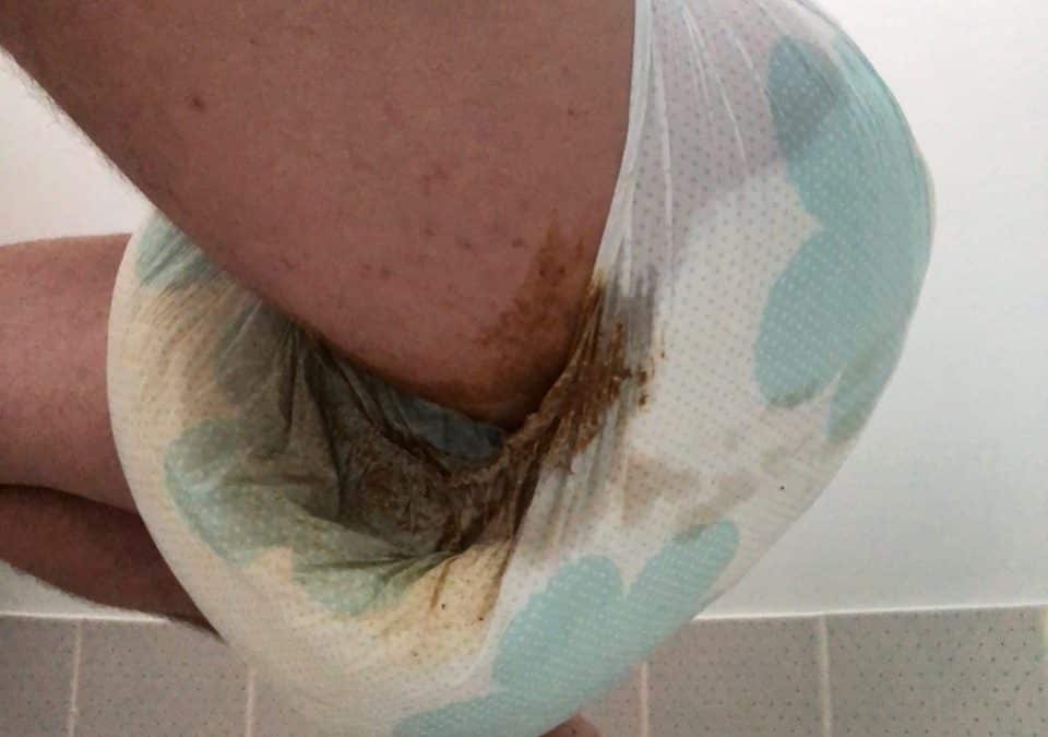 A boy Wearing The Very Dirty leaky diaper