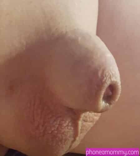 small penis on an adult baby