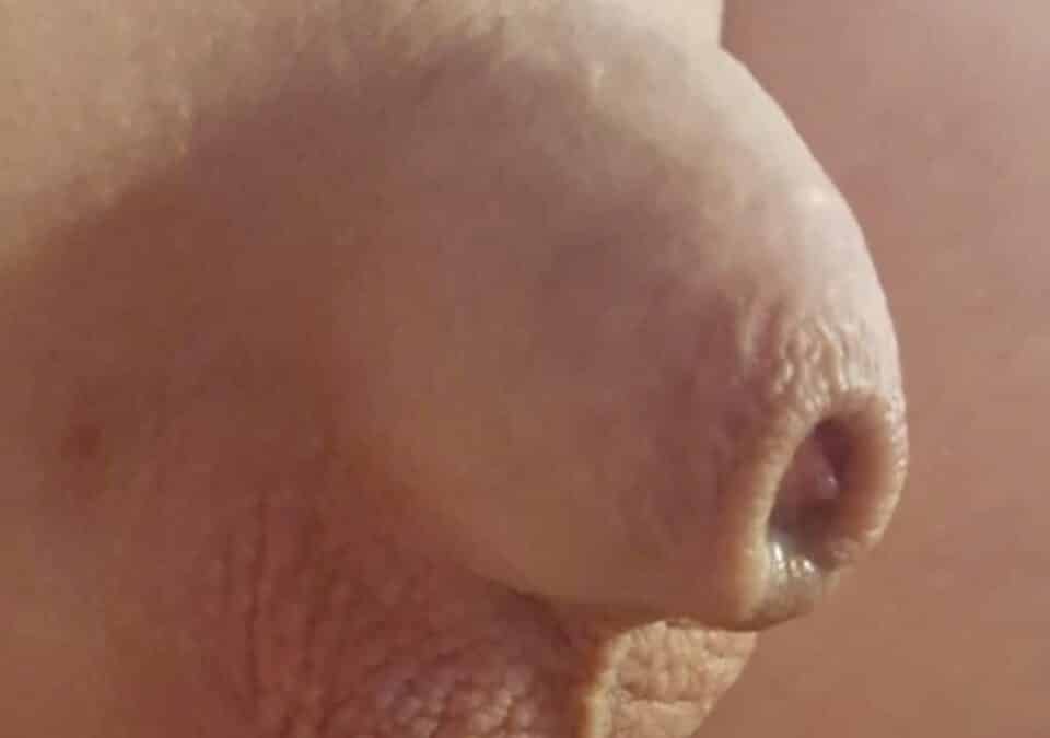 small penis on an adult baby